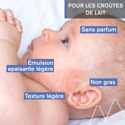 BÉBÉ - 1ER SOIN CROÛTES DE LAIT