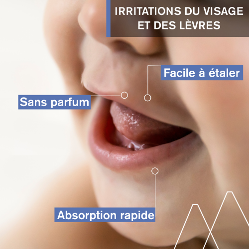 BÉBÉ - 1ER SOIN PÉRI-ORAL