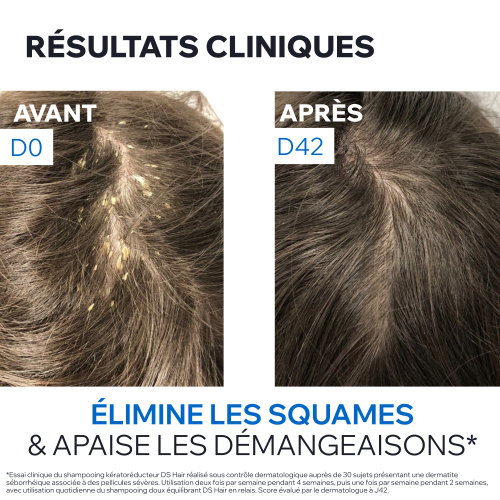 DS HAIR - SHAMPOOING TRAITANT KÉRATORÉDUCTEUR