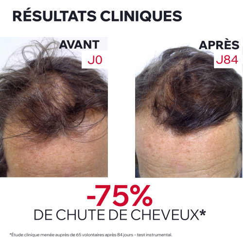 AP HAIR - SÉRUM ANTI-CHUTE INTENSIF