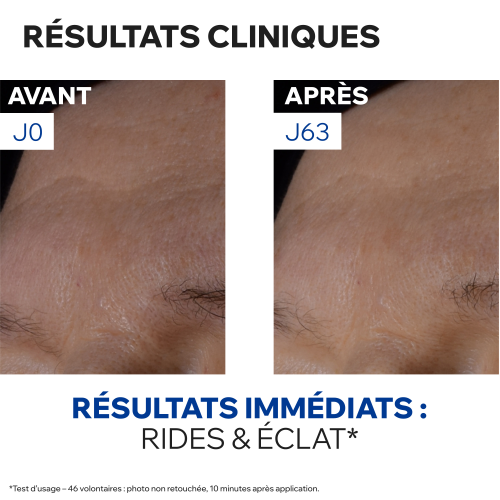 AGE ABSOLU – SOIN DE NUIT REDENSIFIANT