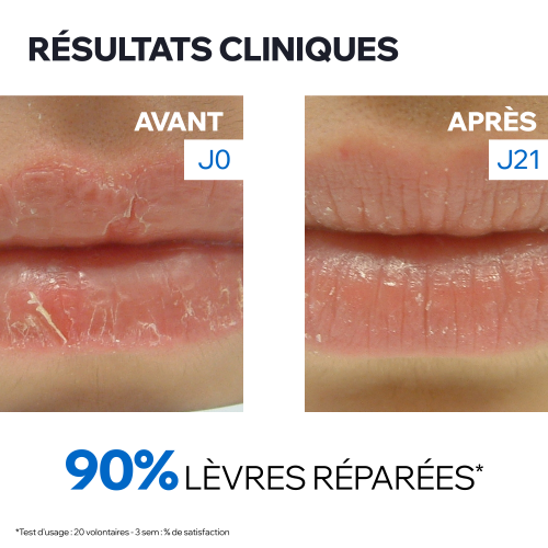 BARIEDERM CICA+ - BAUME LÈVRES RÉPARATEUR