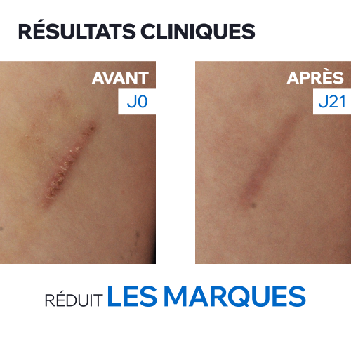 BARIEDERM CICA+ - CRÈME RÉPARATRICE MARQUES CICATRICIELLES