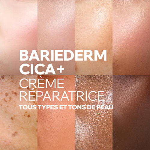 BARIEDERM CICA+ - CRÈME RÉPARATRICE MARQUES CICATRICIELLES