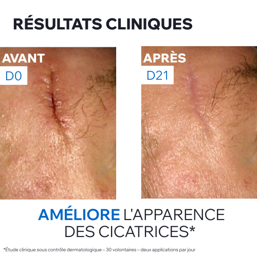 BARIÉDERM-CICA  Crème au cuivre zinc