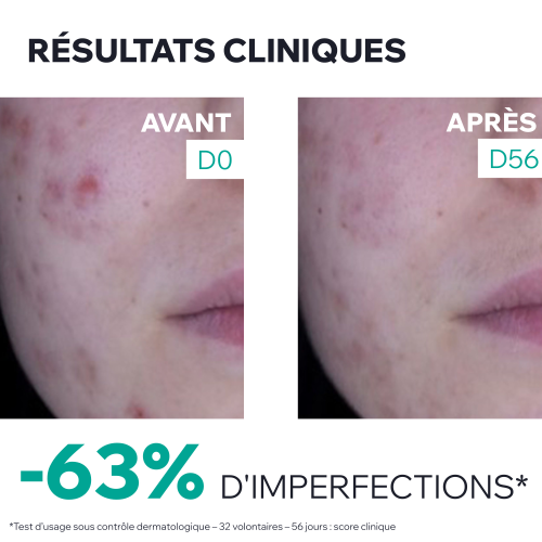 HYSEAC 3-REGUL+ - SOIN GLOBAL ANTI-IMPERFECTIONS
