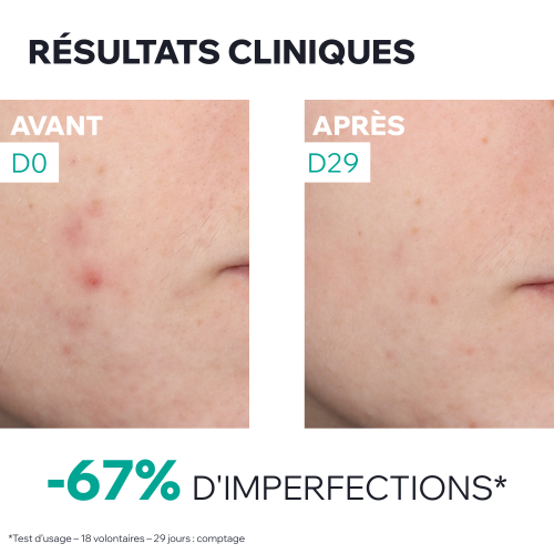HYSEAC - SÉRUM PEAU NEUVE BOOSTER ANTI-IMPERFECTIONS