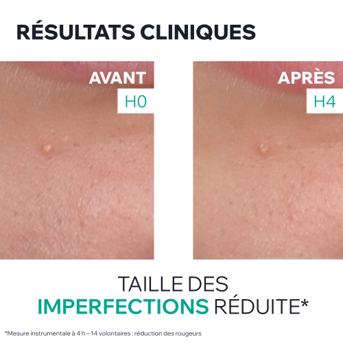 HYSEAC - GEL SOS ASSÉCHANT