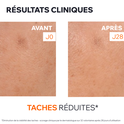 DÉPIDERM - SÉRUM ANTI-TACHES BOOSTER ÉCLAT