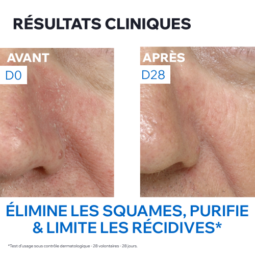 DS - Émulsion Apaisante Régulatrice