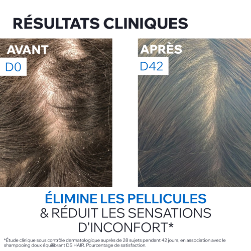 DS HAIR SHAMPOOING TRAITANT ANTIPELLICULAIRE