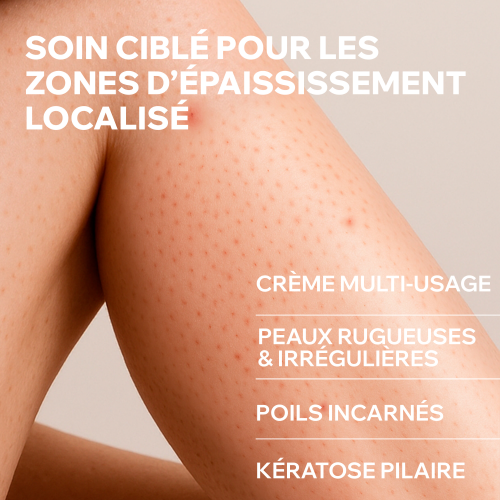 KÉRATOSANE 30 Gel-Crème