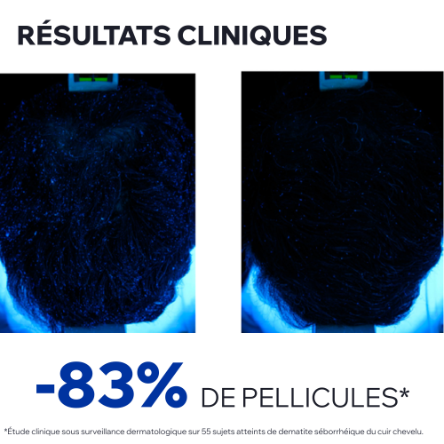 DS HAIR - Lotion Antipelliculaire Régulatrice