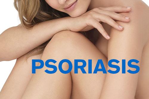Tout savoir sur le psoriasis !