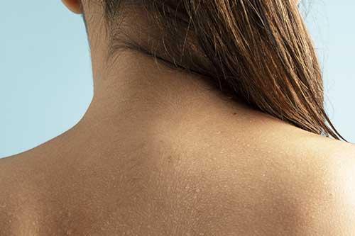Peau et cancer : trouvez les soins adaptés à votre peau fragilisée par les traitements